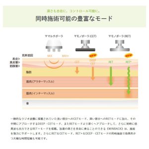 WIN BACK　ウィンバック