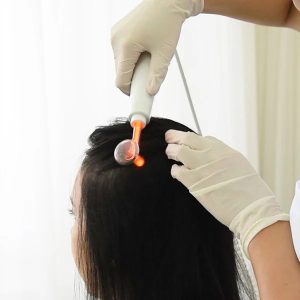 PlasmaScalp　プラズマスカルプ